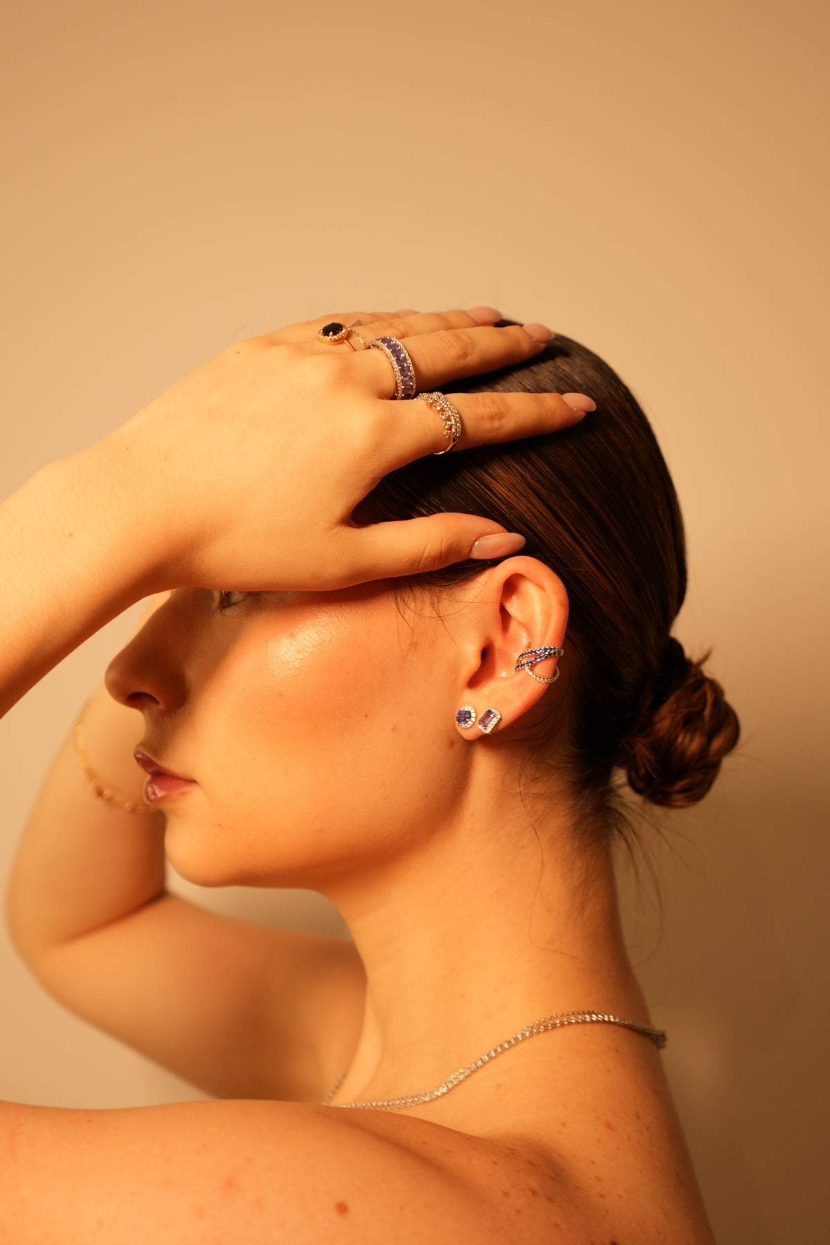 Aretes